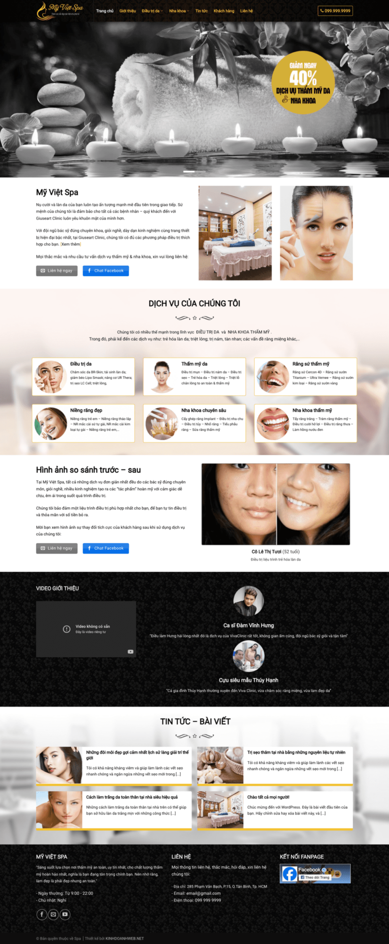 Spa- Mẫu website giới thiệu về dịch dụ spa không có giỏ hàng